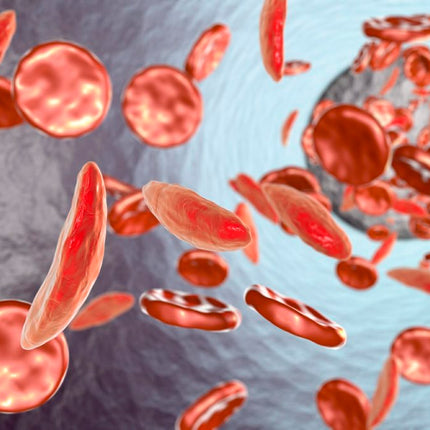 Collection image for: ANEMIA