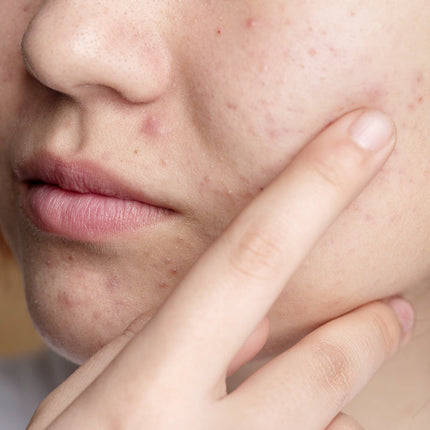 Collection image for: DERMATOLOGY